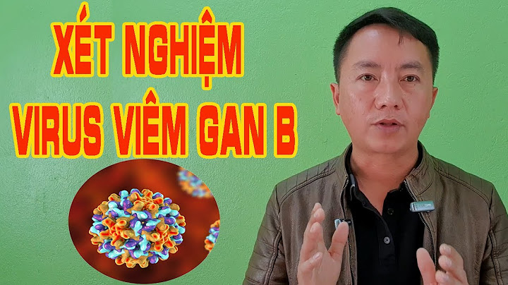 Giá xét nghiệm định lượng virus viêm gan C