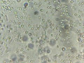 Observation de cellules de levure ( Saccharomyces cerevisiae )