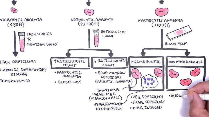 Anaemia (anemia) - classification (microcytic, normocytic and macrocytic) and pathophysiology - DayDayNews