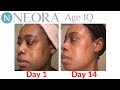 Neora Age IQ Skincare Review