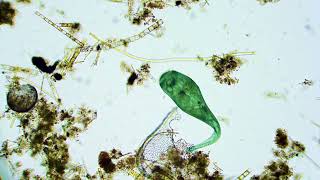 Stentor Video from Pond Water using Cheap Microscope