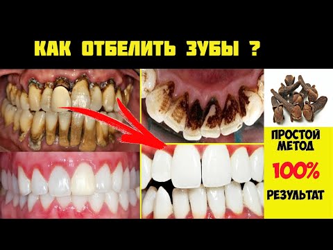 Video: Ku e vendosni lëngun drejtues?