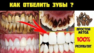 Отбеливание и удаление ЗУБНОГО  КАМНЯ  за одну минуту! Вы получите зубы как жемчуг.