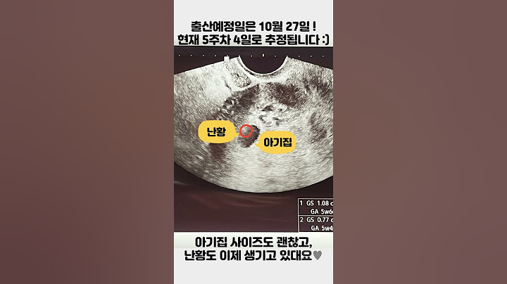 임신5주차 | 아기집 초음파♥난황확인하고왔어요:)