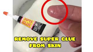 How to remove super glue from skin | How To Basic