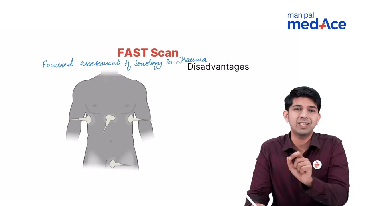 Understanding Abdominal Trauma: Lecture by Dr. Nishanth | Manipal Medace