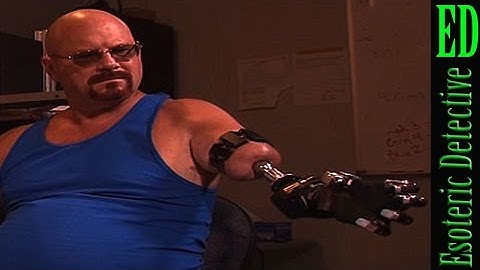 MIND-BLOWING mind-controlled PROSTHETIC ROBOT ARM could revolutionize movement for amputees.