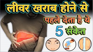 लीवर खराब होने के 5 लक्षण और इलाज | 6 Warning signs of LIVER damage |