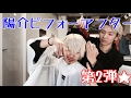 陽介ビフォーアフター第2弾★島崎力斗