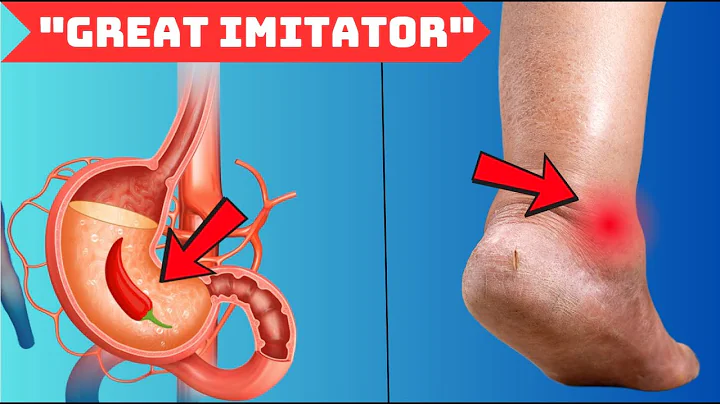 Vitamin B1 Thiamine Deficiency "The Great Imitator " of Other Illnesses