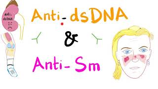 Anti-dsDNA vs Anti-Smith Antibodies