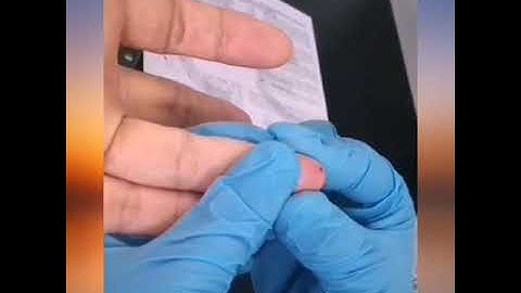 Test Procedure of Accu Tell test rápido COVID 19 Rapid Test