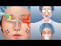 Facial Plastic Surgery Process Explained | Nose, Chin & Eyelid Procedures