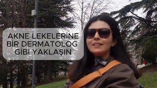 Akne Lekeleri̇ Dosyasi