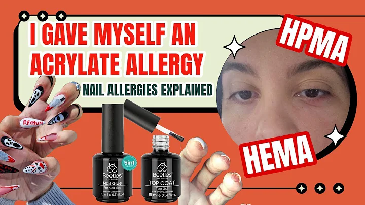 How I Got a Gel Polish Allergy | The Ugly Truth About Your Cheap Nail Products