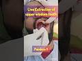 painless upper wisdom tooth live #wisdomtooth #daantnikalna