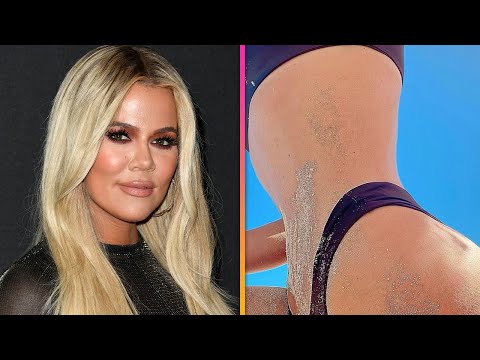 Video: Khloe Kardashian Uses Cheap Stretch Mark Cream