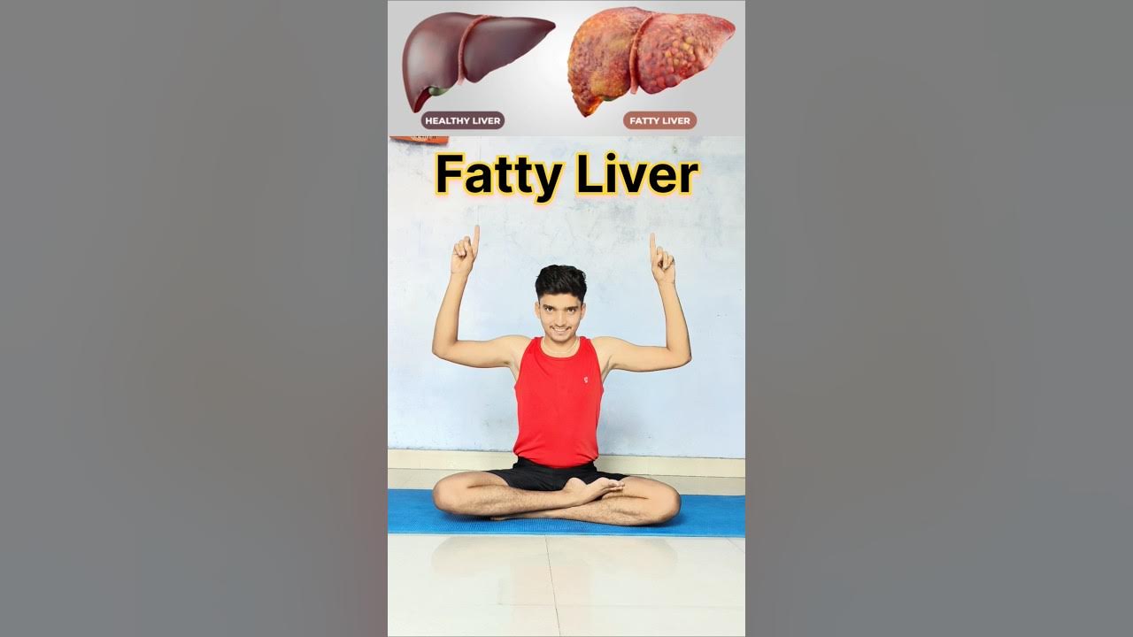 Fatty Liver Health #fattyliver #liver #health #weightloss #yoga #yogalife #ytshorts #explore #foryou Fatty Liver Health #fattyliver #liver #health #weightloss #yoga #yogalife #ytshorts #explore #foryou