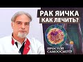 Рак яичка: симптомы и методы лечения