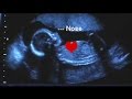 19 Week Ultrasound with Heartbeat - Gina Family