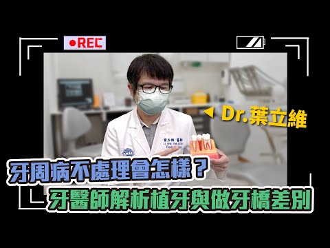 【專訪】牙周病不處理會怎樣？牙醫師解析植牙與做牙橋差別！