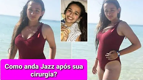 Como ficou a cirurgia da Jazz?