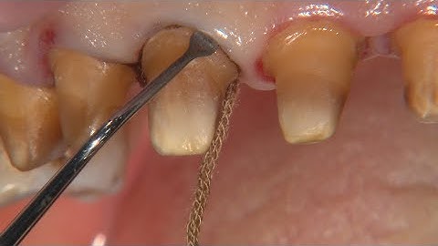 Chairside Live EP 258-Scan School: Scanning Large Cases