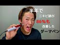 ニキビ跡が半年で86％も改善した治療法【元クレーター男が教えるダーマペンの正しいやり方まとめ】