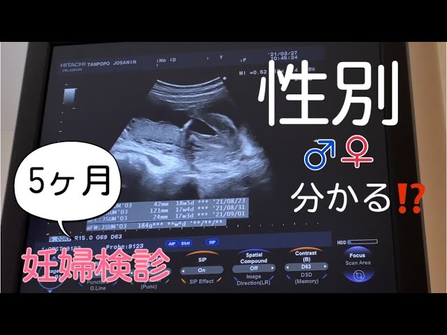 妊娠中期 妊娠5ヶ月 性別判明 編 What Is The Gender Of The 5th Month Pregnant Baby Youtube