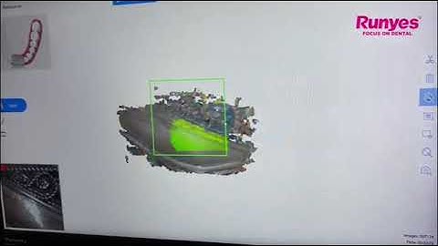 Scanning Metal-Runyes IOS