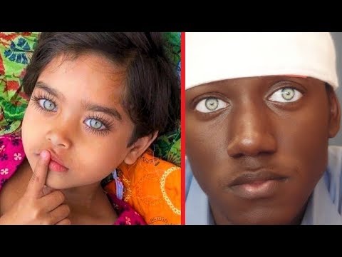 Göz Renkleriyle Tüm Dünyayı KISKANDIRAN 6 İnsan