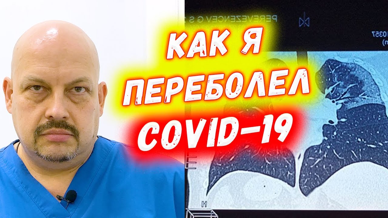 Как я переболел ковидом | SARS COVID-19 | Коронавирус | Григорий Перевезенцев