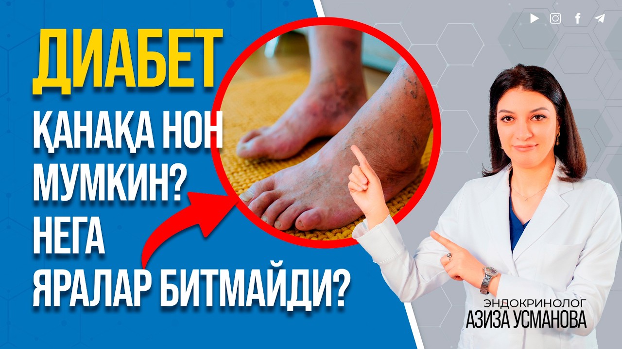 Diabetda non yeyish, parxez tutish, sport mumkinmi?