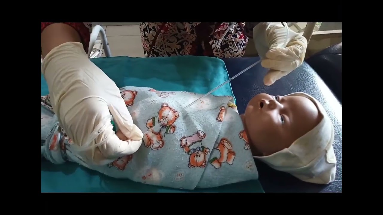 Pemasangan OGT pada BBL//Tugas KKPK semester 2