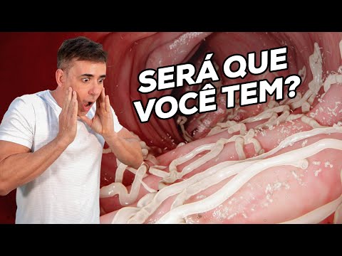 COMO SABER SE ESTOU COM VERME? SINTOMAS E REMÉDIOS NATURAIS | Dr Dayan Siebra