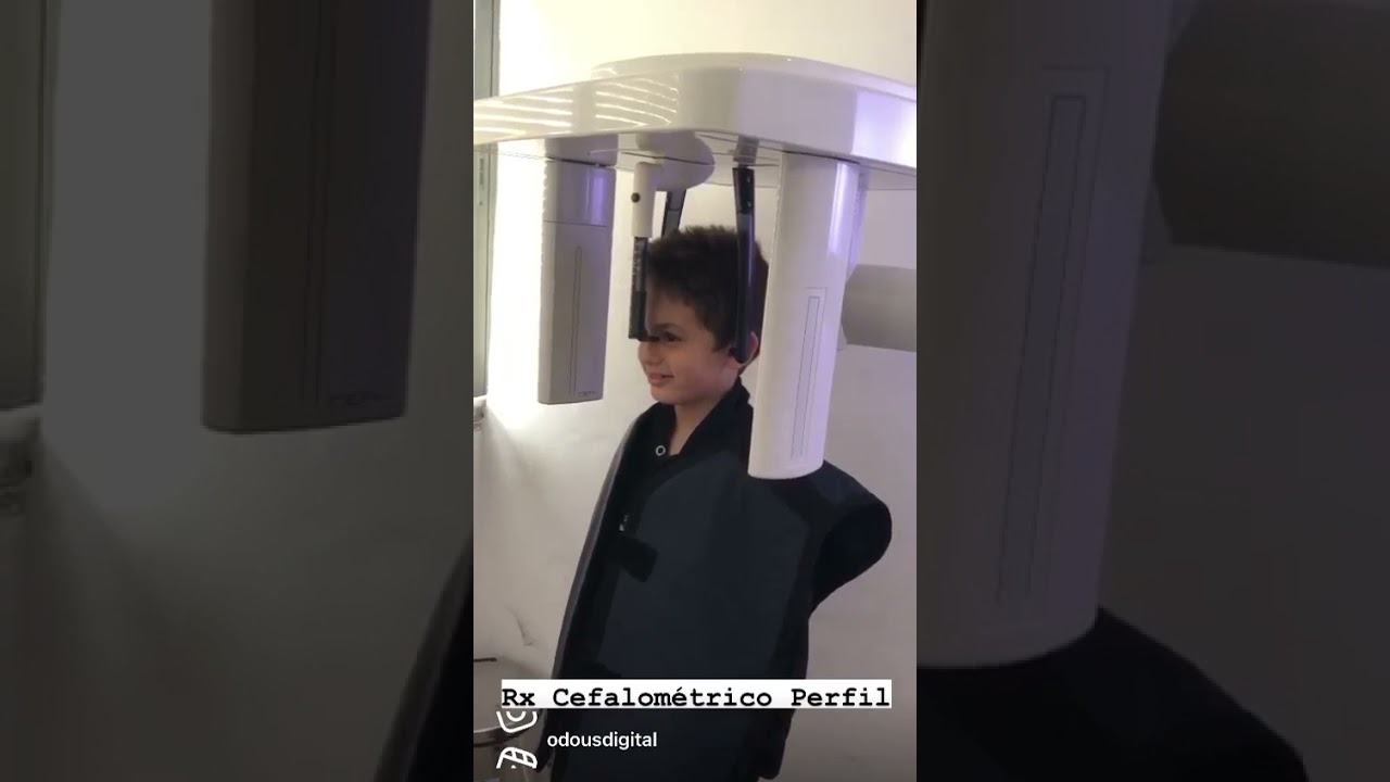 Rx Infantil, Cefalometria de pefil ou teleradiografia