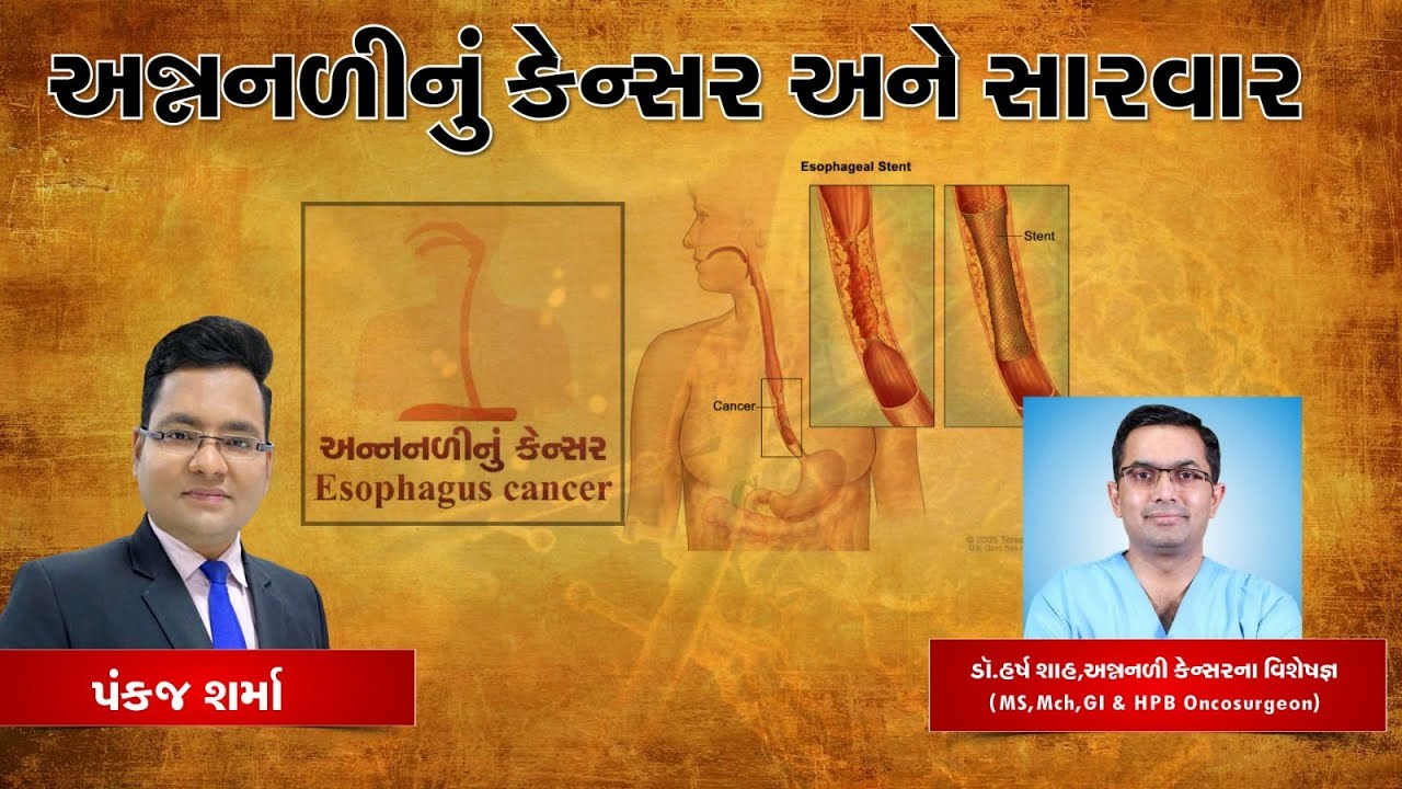 વધી રહ્યા છે અન્નનળીના કેન્સરના કેસ? | જાણો કારણો અને સારવાર | Esophageal Cancer | Dr.Harsh Shah