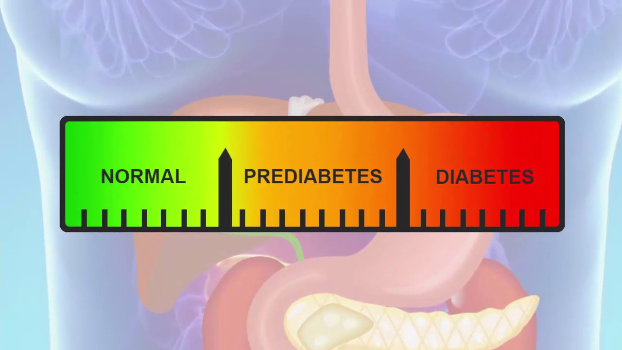 What is Prediabetes Part 2 