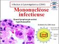 Infection  cytomgalovirus cmv mononuclose infectieuse