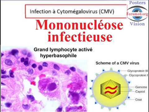 Vidéo: D'où vient le cytomégalovirus ?