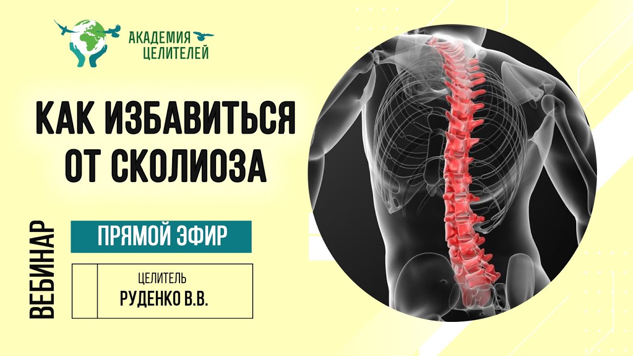 Как избавиться от сколиоза? Тематический вебинар В.В.Руденко. Академия ...