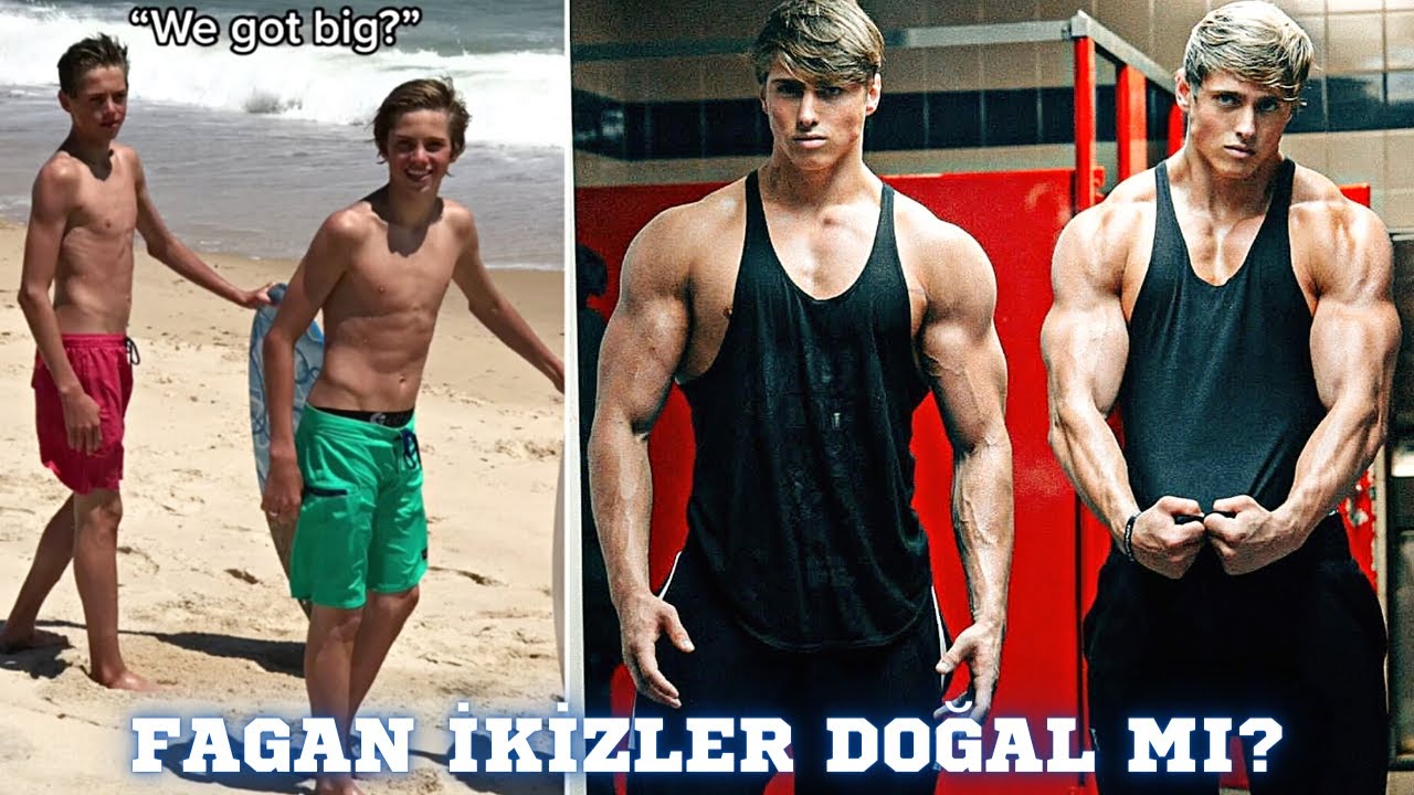 FAGAN İKİZLER DOĞAL MI?