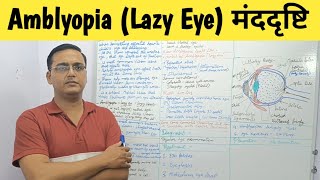 Amblyopia (Lazy Eye) मंददृष्टि | Causes |Symptoms | Treatment | Management @RinkeshPariyaniMedicalED