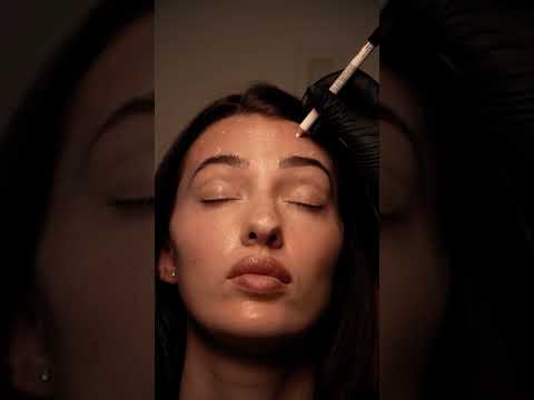 Botox Treatment