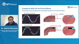 How to overcome a complex PCI case smoothly - SOLACI 2021