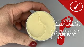 وصفات لعلاج تشقق القدمين  | foot cream