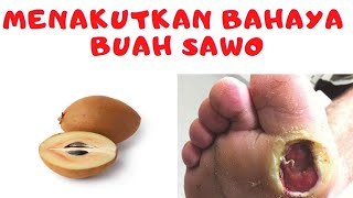 MENAKUTKAN BAHAYA BUAH SAWO