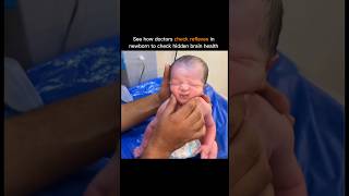 Doctors Checking The Reflexes In Newborn
