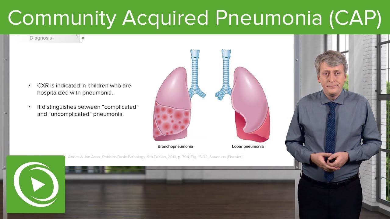 ⁣Community Acquired Pneumonia (CAP) – Pediatrics | Lecturio