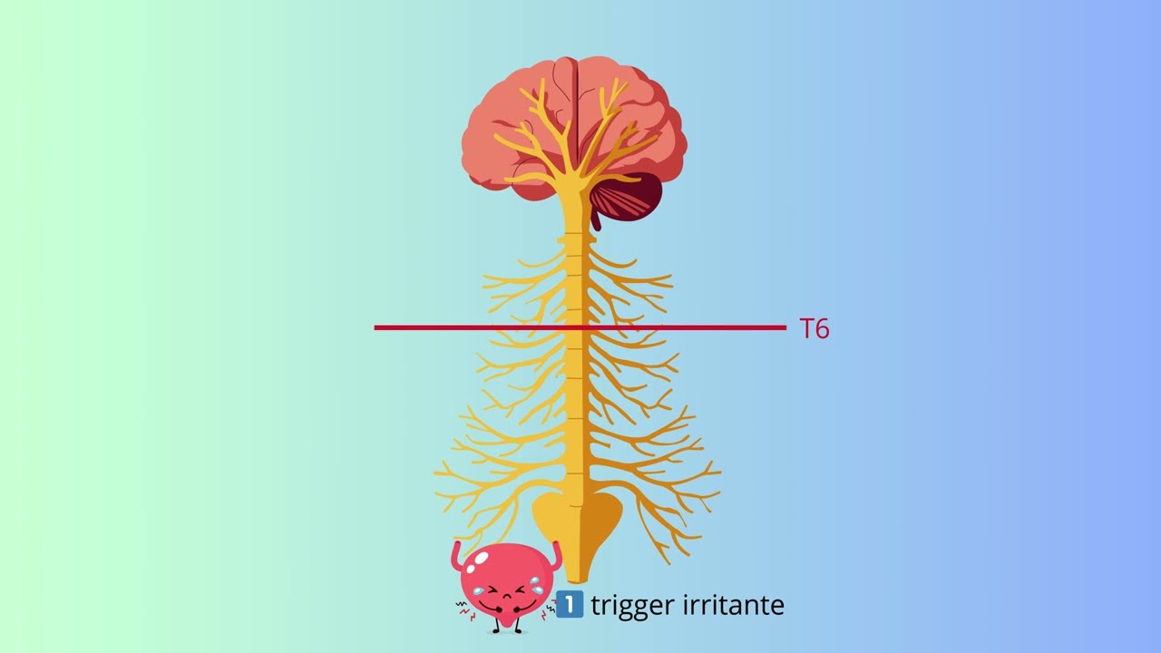 PREVENZIONE E GESTIONE DELLA DISREFLESSIA AUTONOMICA